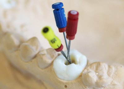 Endodontie 2
